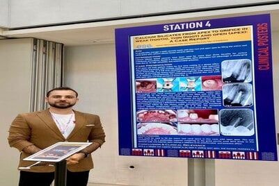 In a remarkable feat, one of our esteemed faculty members had the honor of presenting his case at the prestigious European Society of Endodontology 21st